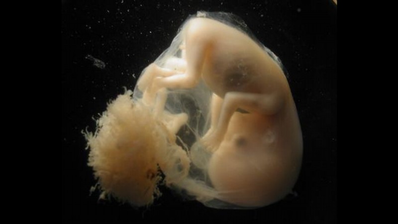 embryo