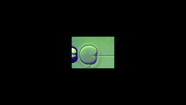 Intrauterinní inseminace (IUI) - obrázek