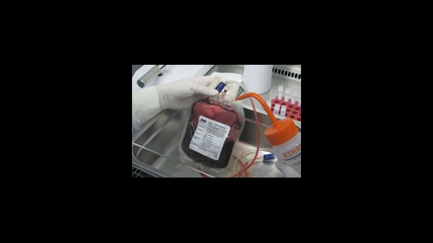 ONEMOCNĚNÍ LÉČITELNÁ TRANSPLANTACÍ PUPEČNÍKOVÉ KRVE - obrázek