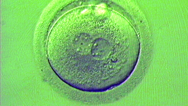 Mužská neplodnost - obrázek