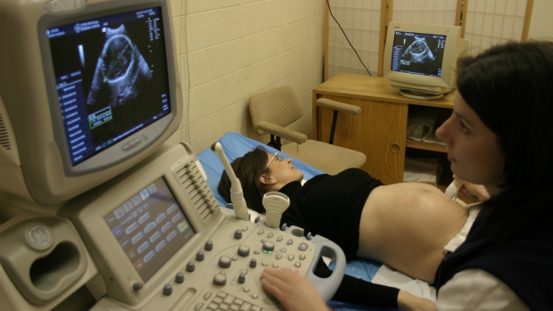 Depistáž a diagnostika vrozených vývojových vad plodu - obrázek