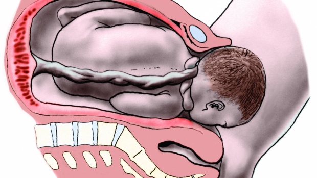 Pohyblivost a přizpůsobivost části plodu - obrázek