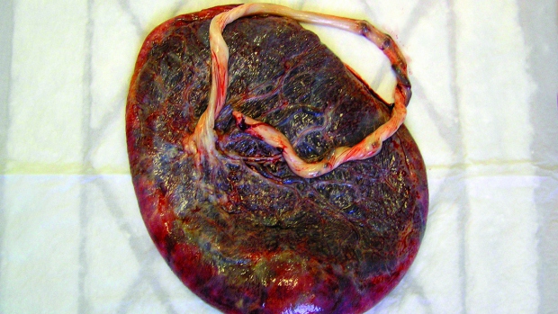 PLODOVÝ KOLÁČ - PLACENTA - obrázek