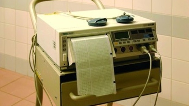 Kardiotokografie - obrázek
