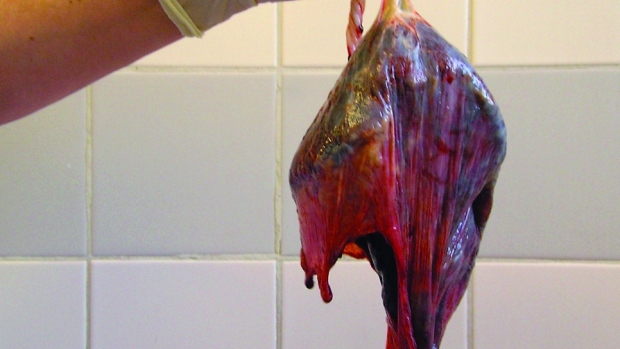 Plodový koláč - placenta - obrázek