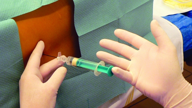 Kombinovaná subarachnoidální a epidurální analgezie - obrázek