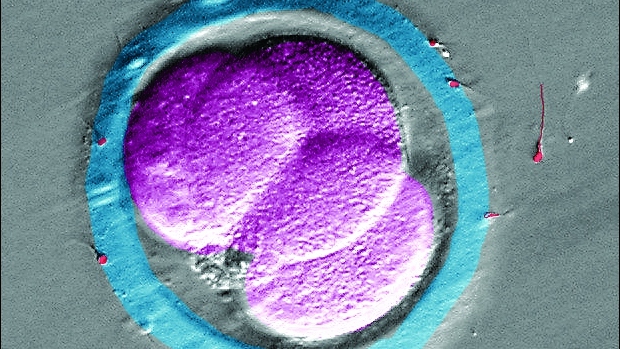 Co je mimotělní oplodnění a IVF+ET - obrázek
