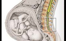 Proč lékaři v prenatální poradně zjišťují rozměry pánve? - obrázek