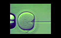 Intrauterinní inseminace (IUI) - obrázek