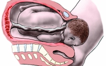 Pohyblivost a přizpůsobivost části plodu - obrázek