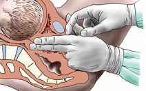 Proč lékaři v prenatální poradně zjišťují rozměry pánve? - obrázek